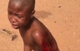 Akure: Woman severely assaults boy in her care for 