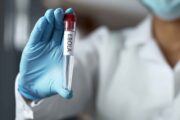 Just in: FG confirms Ebola case in FCT, begins contact tracing
