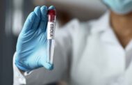 Just in: FG confirms Ebola case in FCT, begins contact tracing