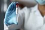 Just in: FG confirms Ebola case in FCT, begins contact tracing